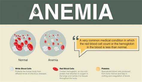 Overview of Anemia: Signs, Symptoms, Causes and Treatment