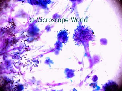 Microscope World Blog Mold Under The Microscope