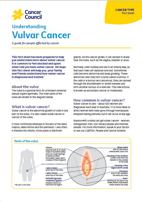 Most Common Metastasis Oof Vulvar Cancer Online Emergencydentistry