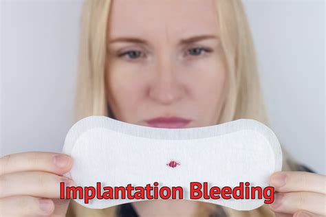 Top Implantation Bleeding Images Amazing Collection Implantation