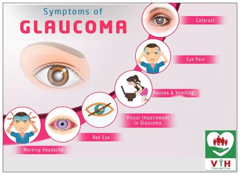 What Are The Symptoms Of Glaucoma | Images and Photos finder