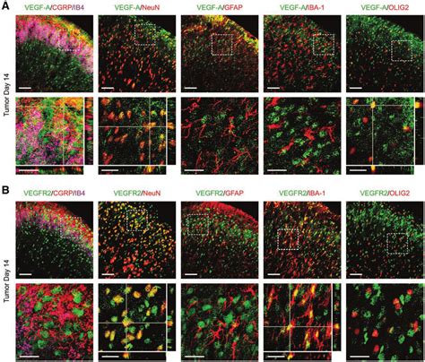 Cellular Localization Of Vascular Endothelial Growth Factor A Vegf A