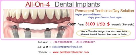 All On 4 Implant Technique India All On 4 Dental Implants Treatment