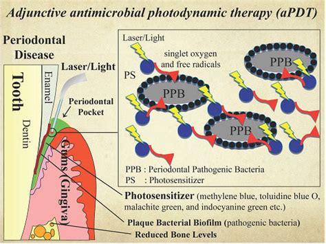 Ijms Free Full Text Adjunctive Application Of Antimicrobial Photodynamic Therapy In