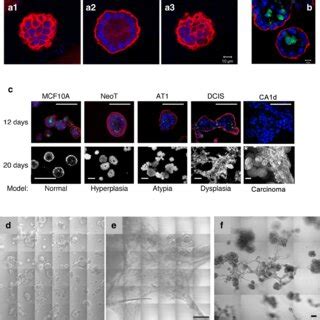 Mcf A Human Breast Epithelial Cells Develop Over Time Into Clusters