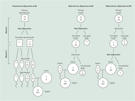 Klinefelter S Syndrome The Lancet The Best Porn Website