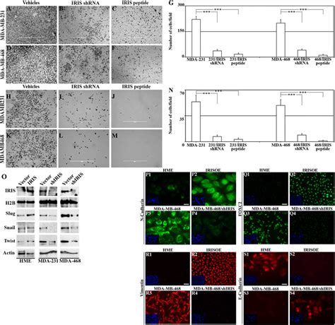 Brca Iris Overexpression Promotes Emt And Invasion In Hme Cells While