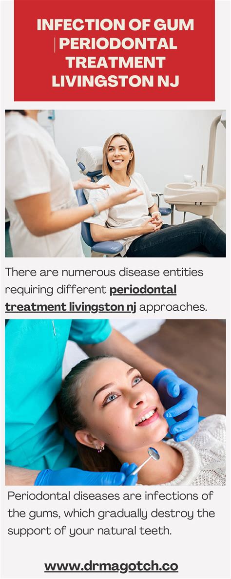 Ppt Infection Of Gum Periodontal Treatment Livingston Nj Powerpoint Presentation Id11692176