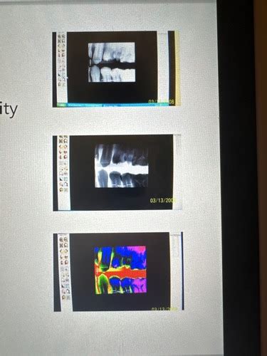 Digital Radiography Flashcards Quizlet