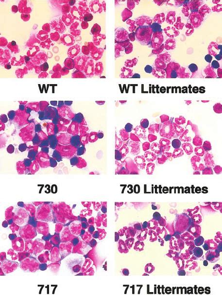 Morphology Of Bone Marrow Cells In Tg Mice Myeloid Cells At Various