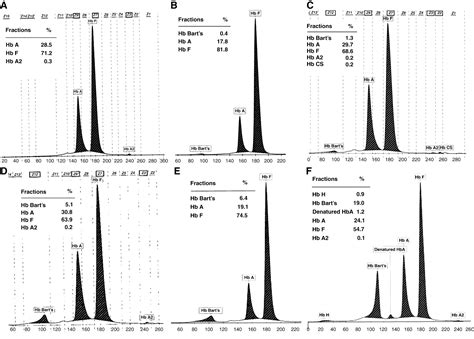 Figure 2 From Thalassemia And Hemoglobinopathies In Southeast Asian