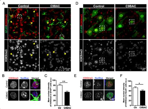 Reduced H K Me Staining At Chromocenters In Spinal Cord Glial Cells