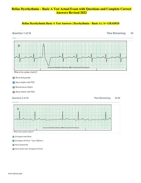 SOLUTION Relias Dysrhythmia Basic A Test Actual Exam With Questions