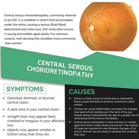 Central Serous Retinopathy Symptoms