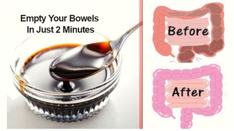 Homemade Laxative Recipe: You will Empty Your Bowels in 2 minute!