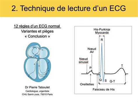 Archives des Vidéos Cours e cardiogram