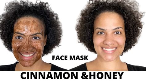 Diy Cinnamon Honey Face Mask For Acne Youtube