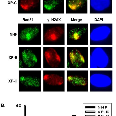 Ddb2 And Xpc Facilitate Brca1 And Rad51 Recruitment To The Uv Damage