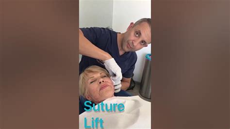 Suture Lift Cyprus Facial Surgery Youtube