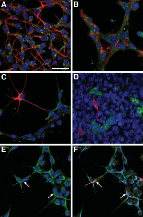 Expression of the hepatocyte growth factor (HGF) receptor c-Met in ...