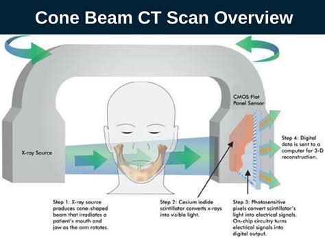 Dental Cone Beam CT Scan Burbank My Dentist Burbank