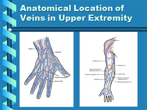 Iv Placement Chart