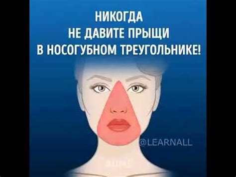 Какие прыщи давить нельзя: Прыщи, давить которые опасно для здоровья ...