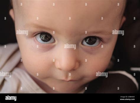 Biggest Eyes In The World Human