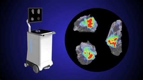 Immediate High Resolution PET CT In The OR With The XEOS AURA 10