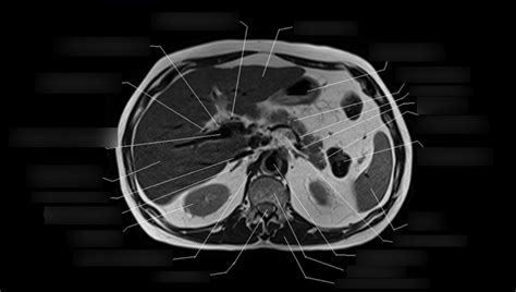 Med Imaging Gi Mri Transverse Diagram Quizlet