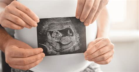 13 Week Ultrasound Pictures