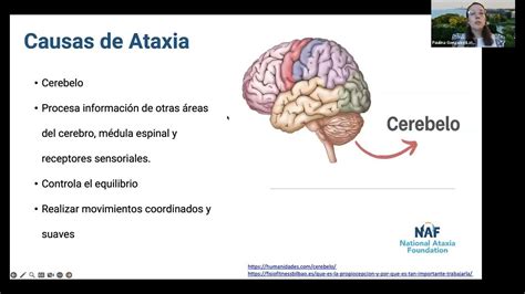 Todo Sobre La Ataxia All About Ataxia In Spanish Youtube