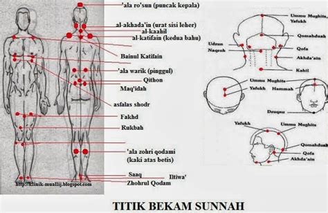 Pusat Terapi AMH Titik Bekam Sunnah Dan Kelebihannya