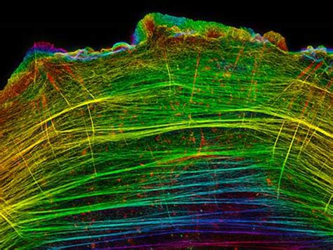 Structured Illumination Microscopy | Techniques | Nikon’s Small World