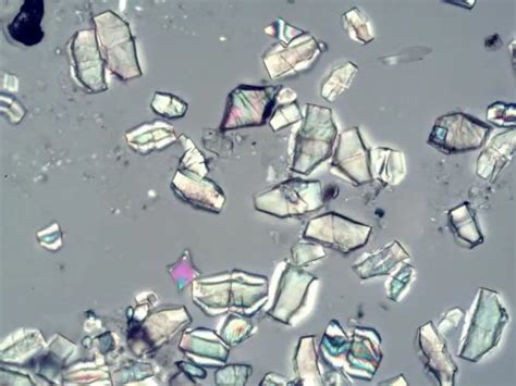 What are cell inclusions? Cellular inclusions: types, structure and ...