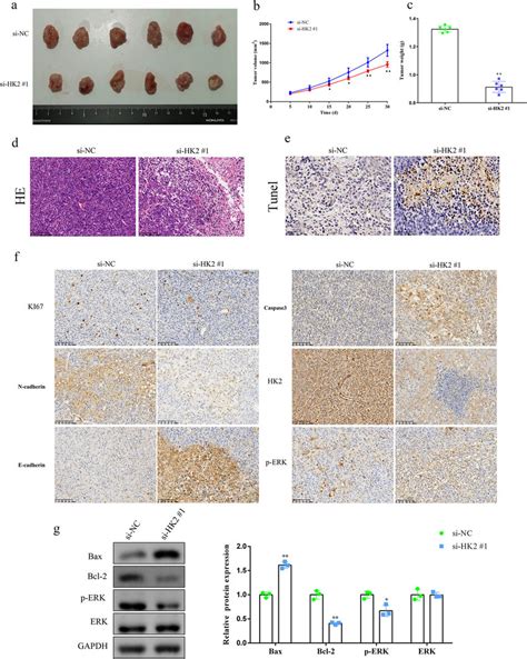 Hk Knockdown Suppresses Dlbcl Tumor Growth In Vivo A Representation