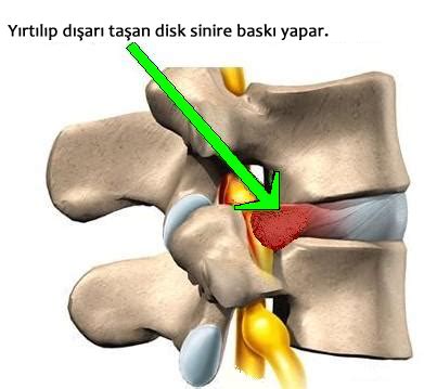 Biyolojisitesi Net Destek Ve Hareket Sistemi Nsanda Skelet Sistemi