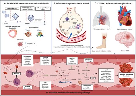 Coronavirus Disease Associated Thrombosis And Coagulopathy Review