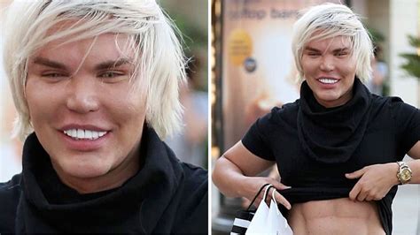 Con Más De 57 Operaciones Así Luce Rodrigo Alves Conocido Como El “ken