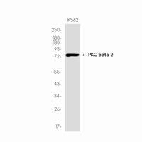 PKC Beta 1 Rabbit MAb NewEast Biosciences GTPase Oncogene And