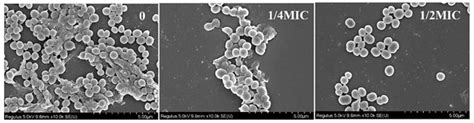 Molecules Free Full Text Anti Biofilm And Anti Hemolysis Activities