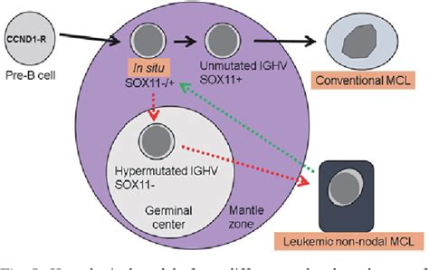 Figure 1 From An Overlapping Case Of In Situ Mantle Cell Neoplasia And Leukemic Non Nodal Mantle