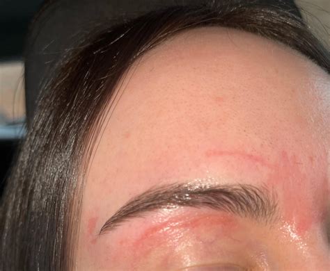 Help My Skin Ripped Off After Getting My Eyebrows Waxed I Know My Mistake Using Retinol The