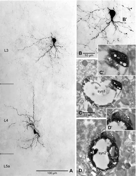 Correlated Light And Electron Microscopic Analysis Of A Synaptically