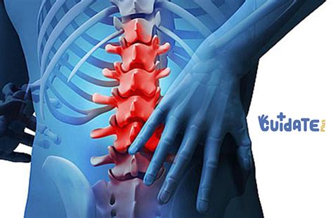 Lumbalgia Qué Es Síntomas Causas Y Tratamiento Cómo Ayuda La