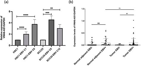 The Oncogenic Role of VWA8-AS1, a Long Non-Coding RNA, in Epstein–Barr