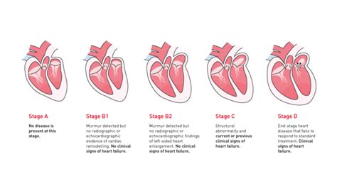 What Are The Stages Of Heart Failure In Dogs