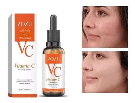 Crema Serum Original Adiós Manchas Paño Pecas Poros Abiertos Meses