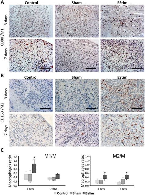 Immunohistochemistry Analysis Of CD80 Marker For M1 Macrophages And