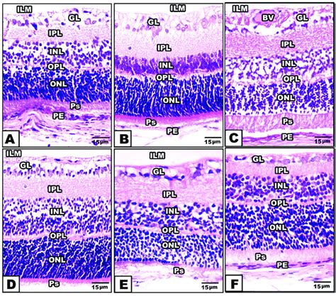 Photomicrographs Of Cross Histological Sections Of Retina Of Offspring